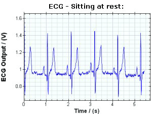 ECG Graph
